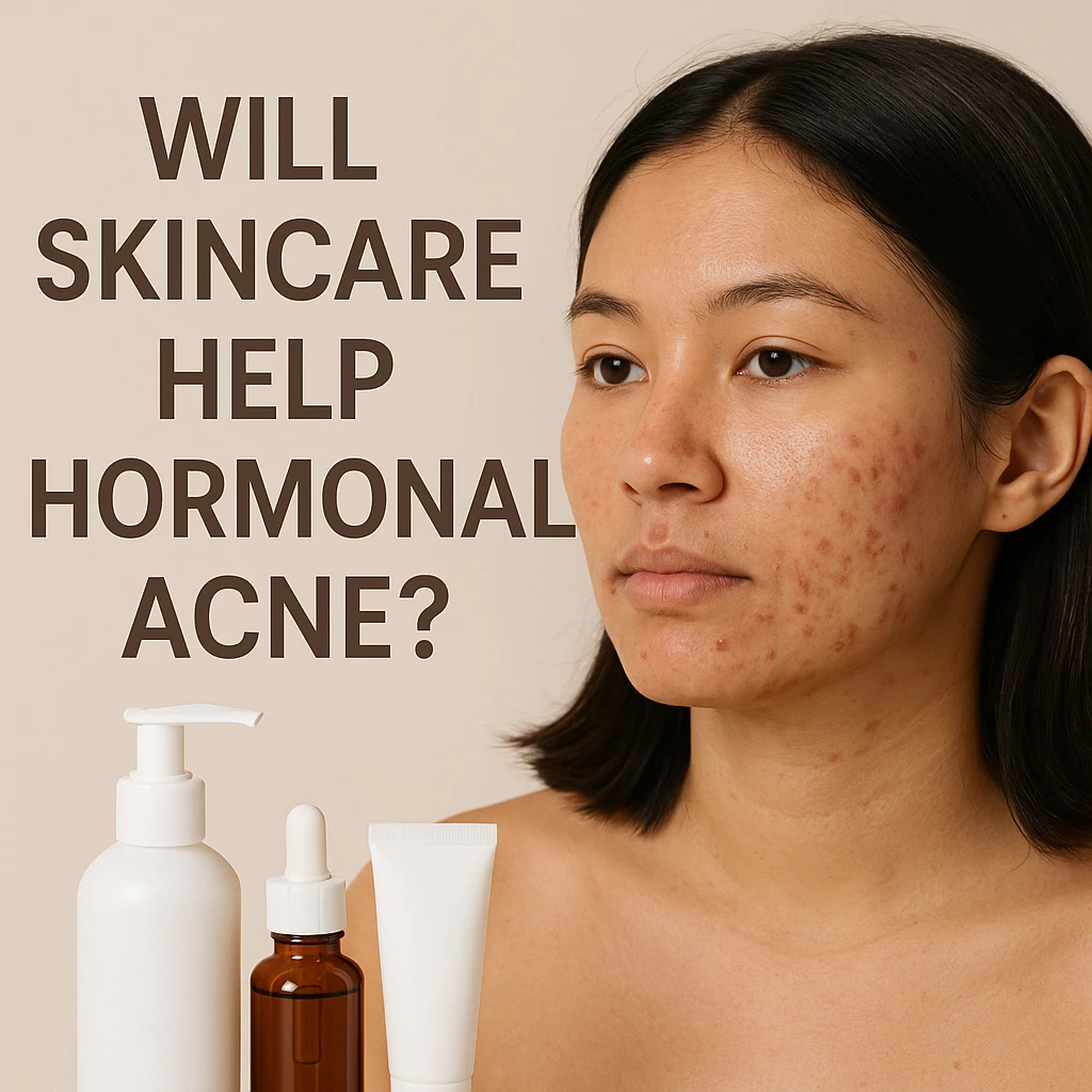 Will skincare help harmonal acne