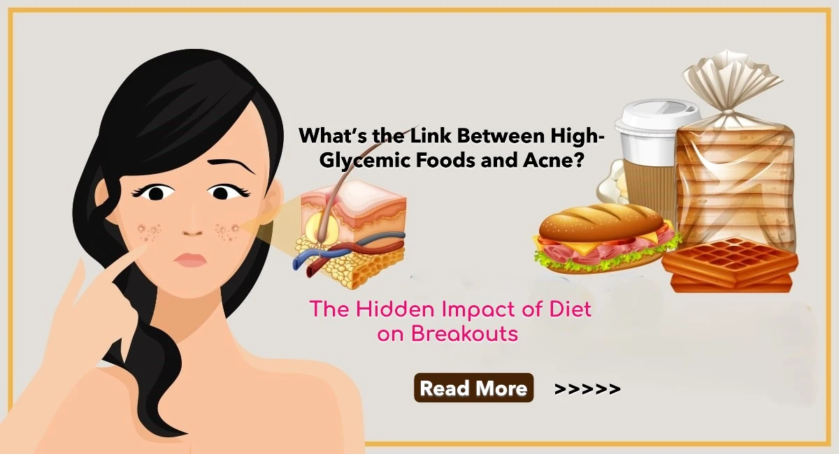 What’s the Link Between High-Glycemic Foods and Acne? The Hidden Impact of Diet on Breakouts