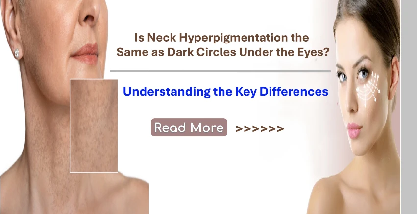 Is Neck Hyperpigmentation the Same as Dark Circles Under the Eyes? Understanding the Key Differences