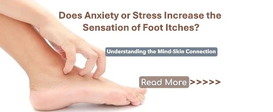 Does Anxiety or Stress Increase the Sensation of Foot Itches? Understanding the Mind-Skin Connection