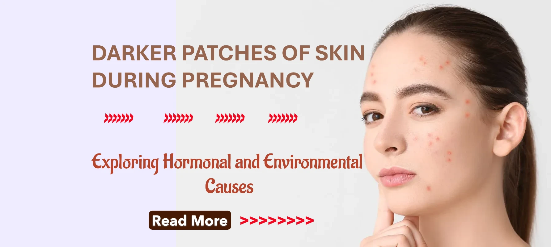 Why Do Some Women Develop Darker Patches of Skin During Pregnancy? Exploring Hormonal and Environmental Causes