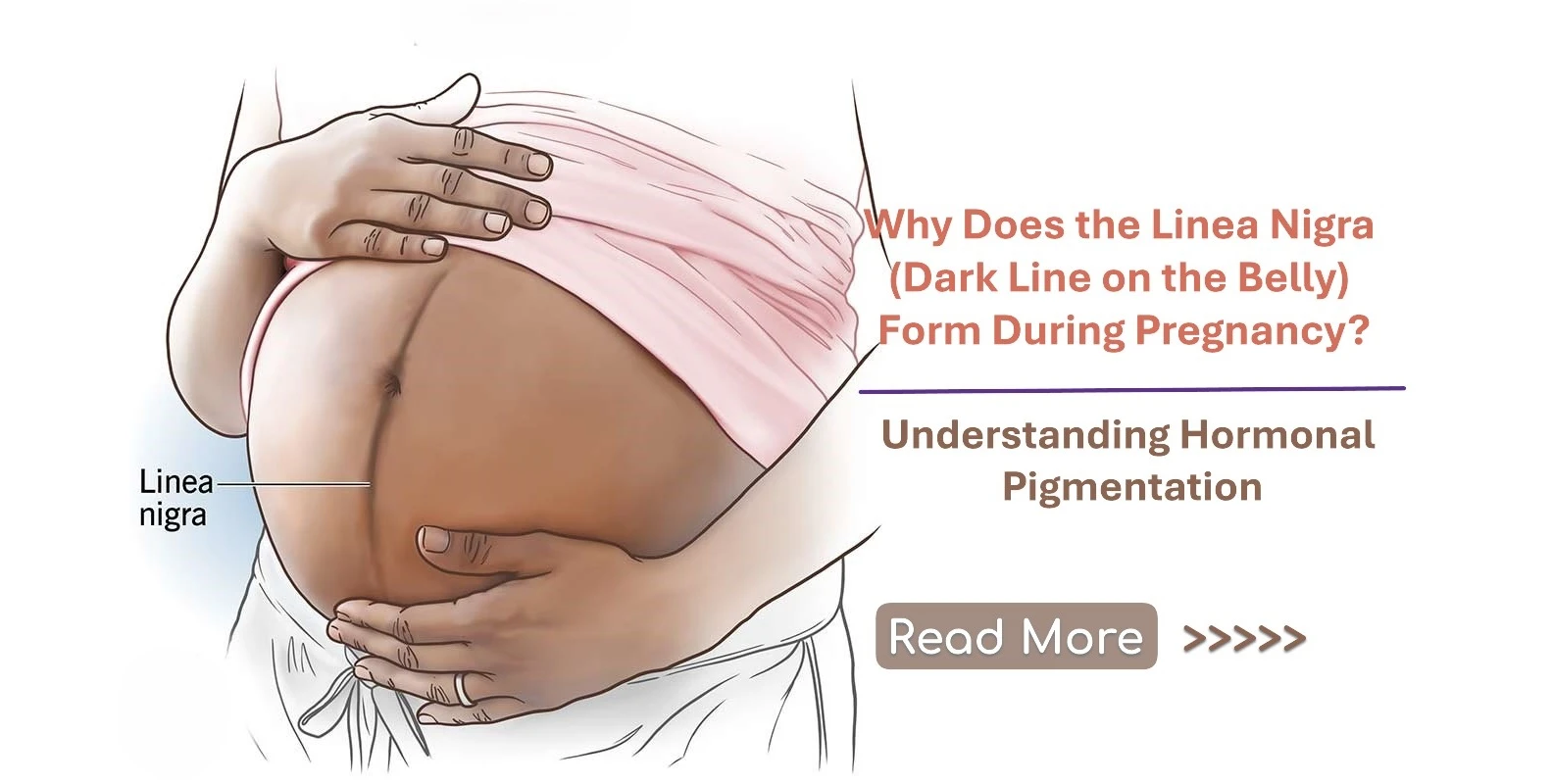 Why Does the Linea Nigra (Dark Line on the Belly) Form During Pregnancy? Understanding Hormonal Pigmentation