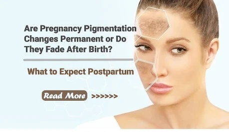 Are Pregnancy Pigmentation Changes Permanent or Do They Fade After Birth? What to Expect Postpartum