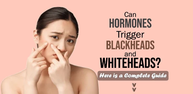Can Hormones Trigger Blackheads and Whiteheads? Understanding the Link Between Hormonal Changes and Acne