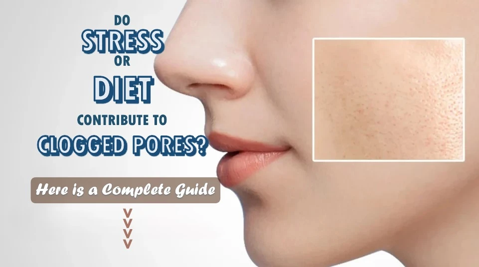 Do Stress or Diet Contribute to Clogged Pores? Exploring the Hidden Triggers Behind Breakouts