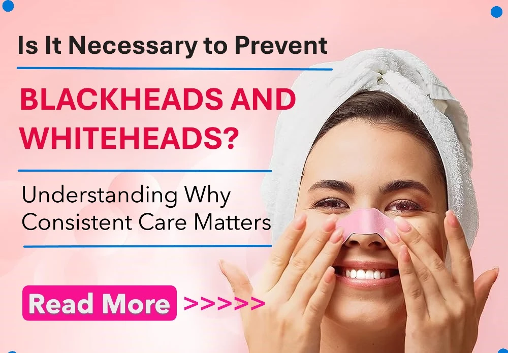 Is It Necessary to Prevent Blackheads and Whiteheads? Understanding Why Consistent Care Matters