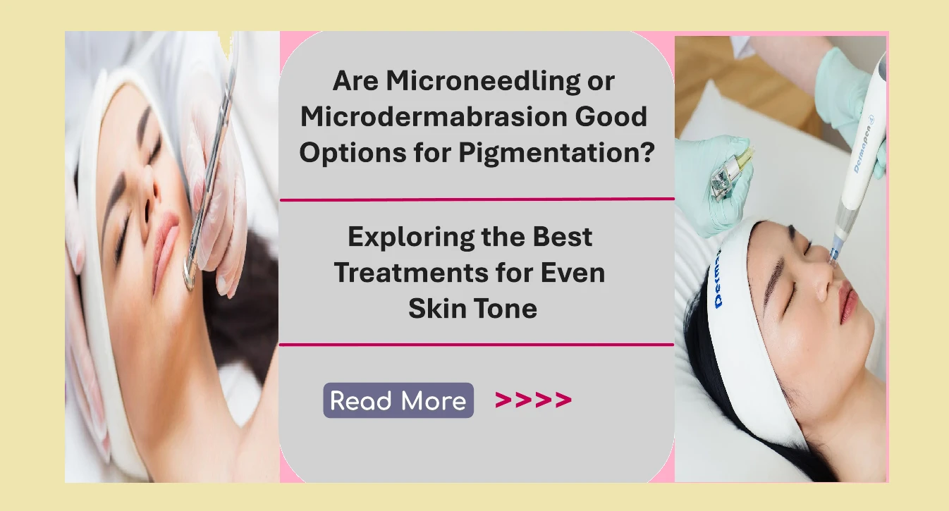Are Microneedling or Microdermabrasion Good Options for Pigmentation? Exploring the Best Treatments for Even Skin Tone