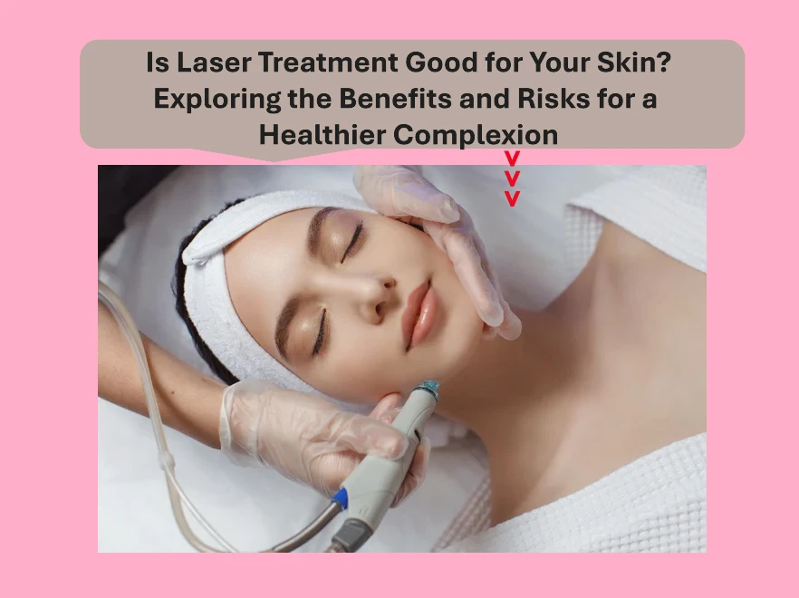 Is Laser Treatment Good for Your Skin? Exploring the Benefits and Risks for a Healthier Complexion