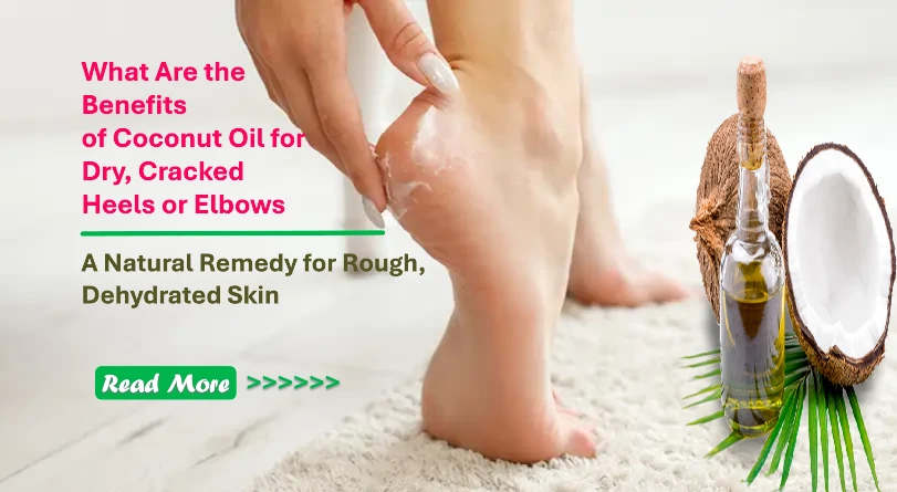 What Are the Benefits of Coconut Oil for Dry, Cracked Heels or Elbows? A Natural Remedy for Rough, Dehydrated Skin