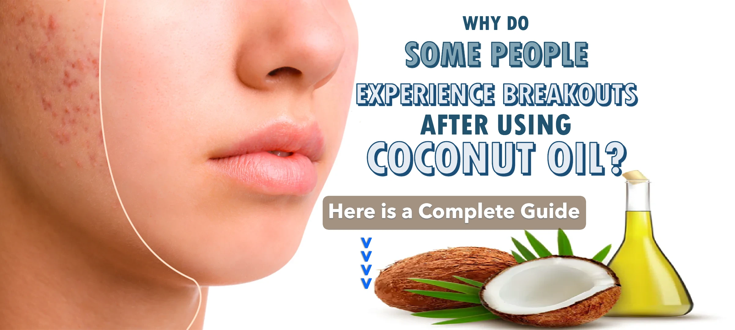 Why Do Some People Experience Breakouts After Using Coconut Oil? Understanding Its Comedogenic Effects on the Skin