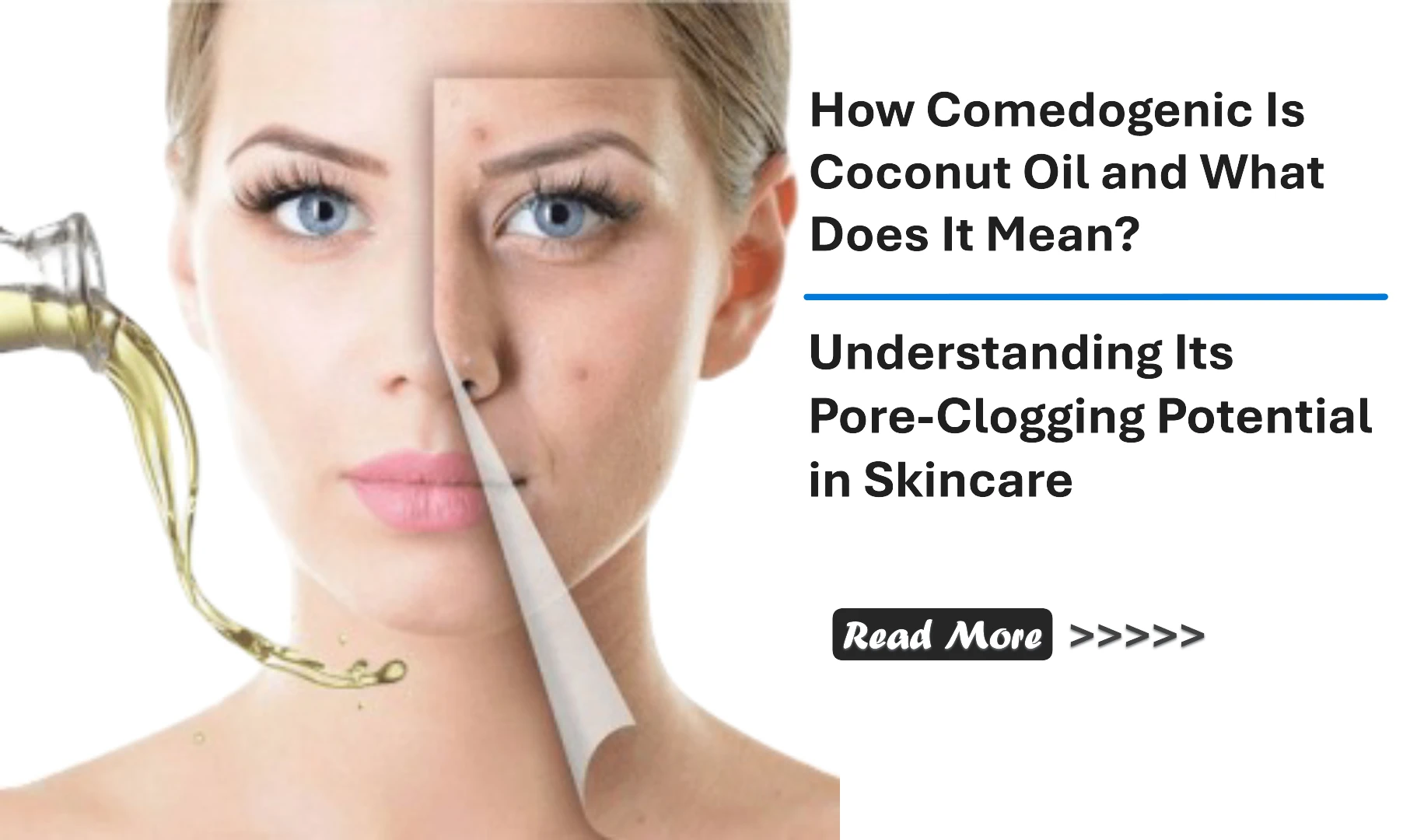 How Comedogenic Is Coconut Oil and What Does It Mean? Understanding Its Pore-Clogging Potential in Skincare