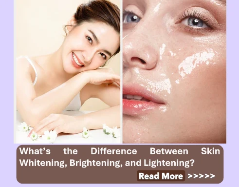 What’s the Difference Between Skin Whitening, Brightening, and Lightening? Clarifying Common Skincare Terms for a Healthier Complexion