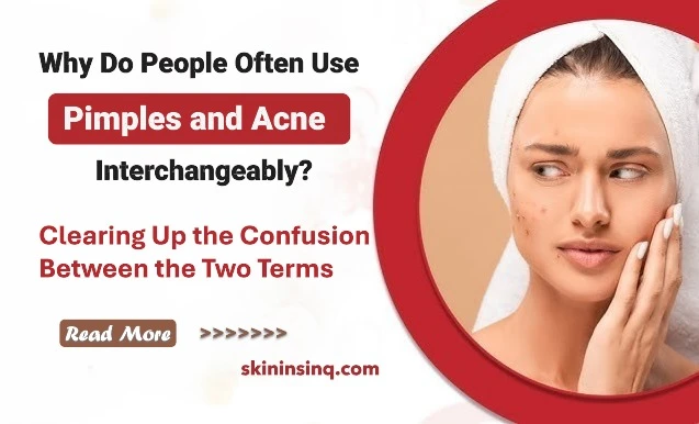 Why Do People Often Use "Pimples" and "Acne" Interchangeably? Clearing Up the Confusion Between the Two Terms
