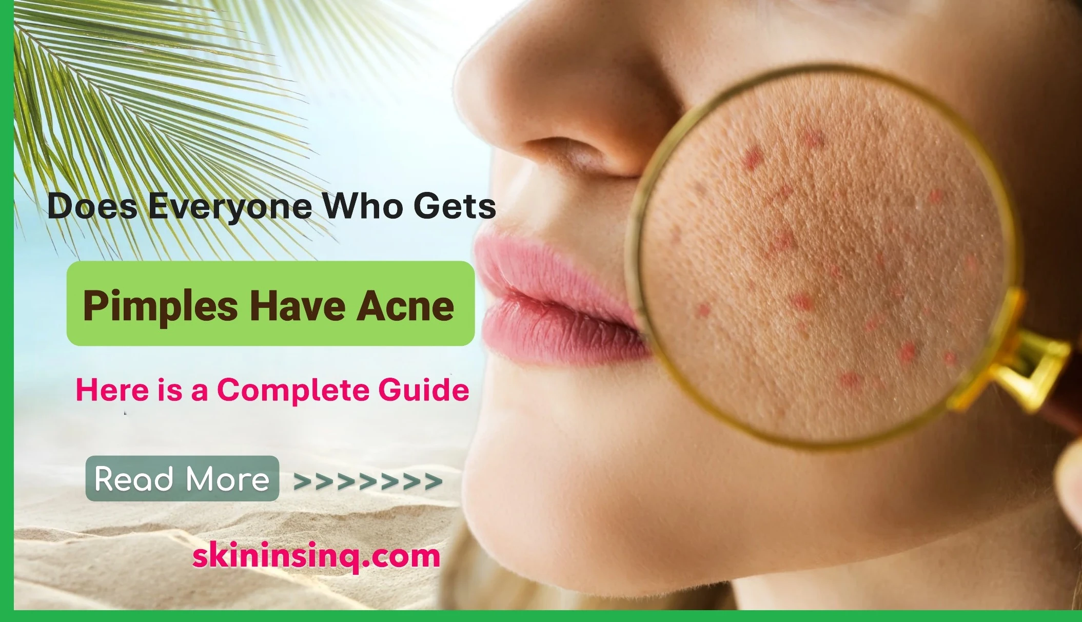 Does Everyone Who Gets Pimples Have Acne? Understanding the Difference Between Occasional Breakouts and Acne