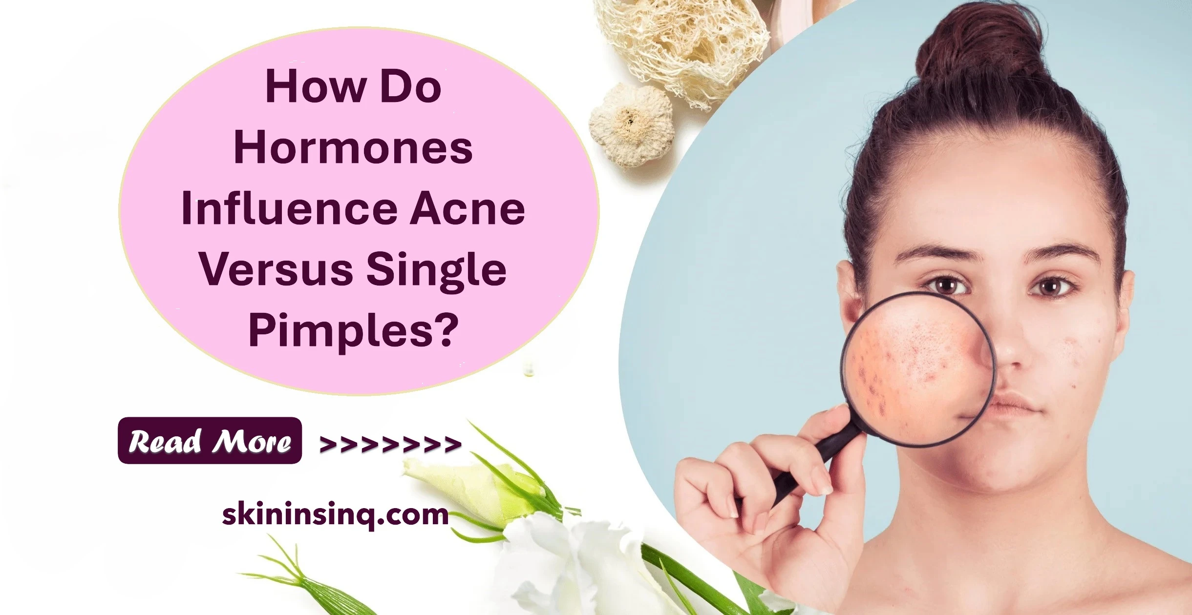 How Do Hormones Influence Acne Versus Single Pimples? Understanding the Hormonal Impact on Skin Breakouts