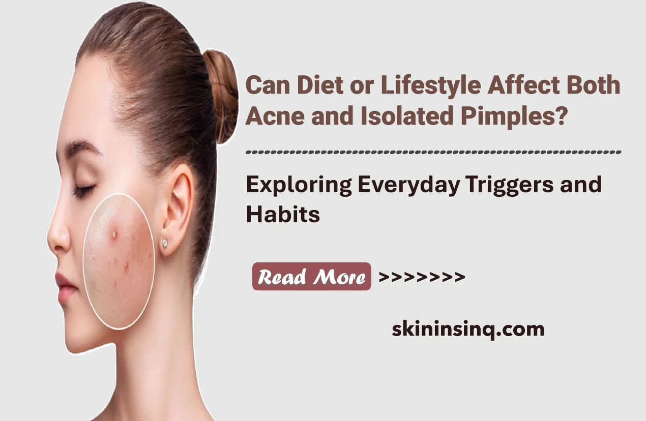 Can Diet or Lifestyle Affect Both Acne and Isolated Pimples? Exploring Everyday Triggers and Habits