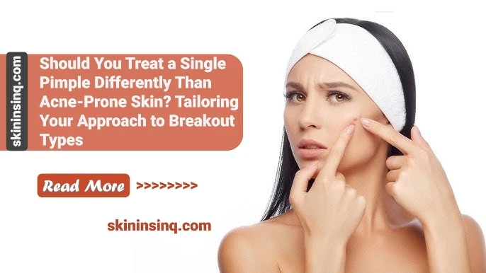 Should You Treat a Single Pimple Differently Than Acne-Prone Skin? Tailoring Your Approach to Breakout Types