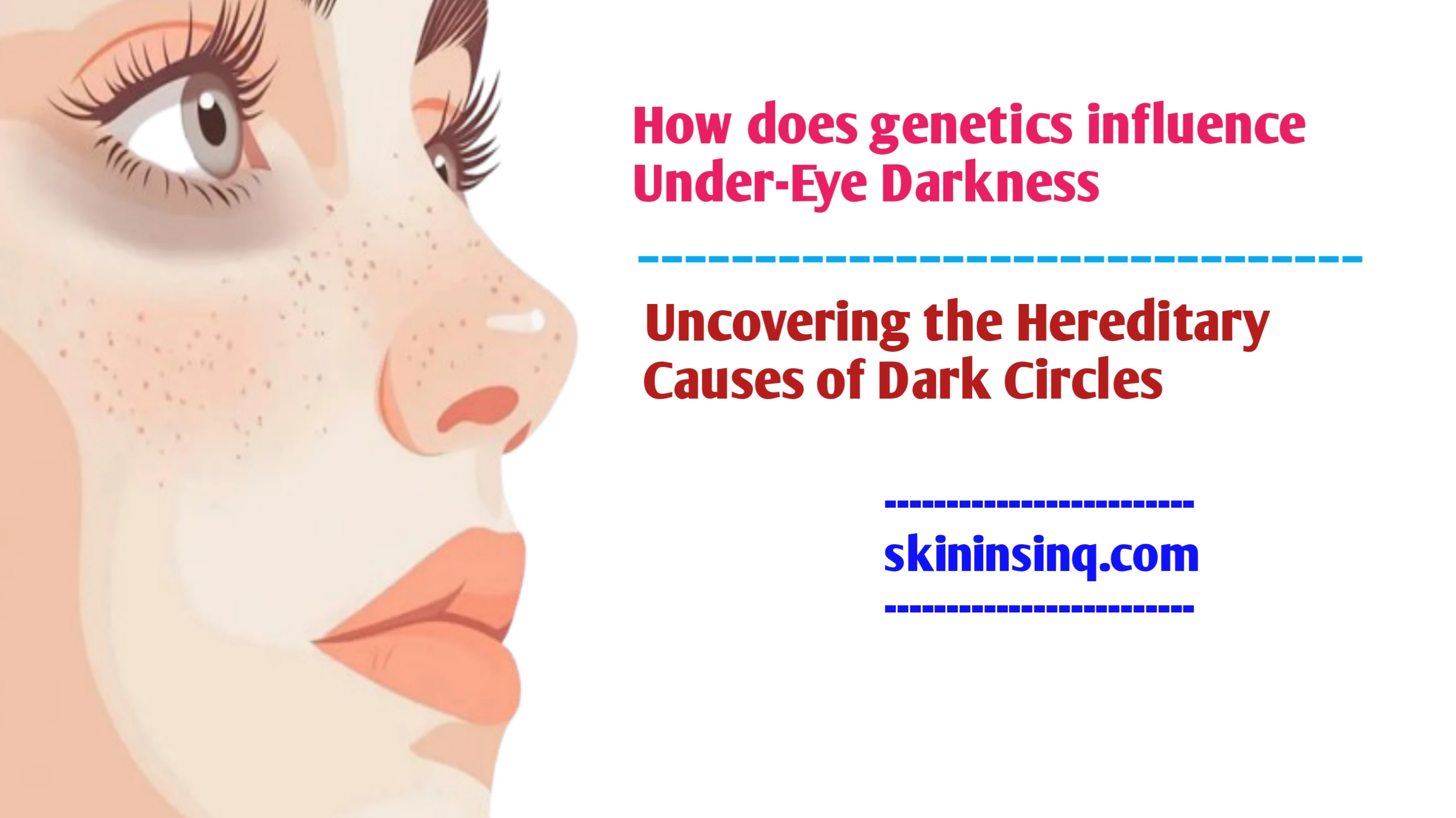 How Does Genetics Influence Under-Eye Darkness? Uncovering the Hereditary Causes of Dark Circles
